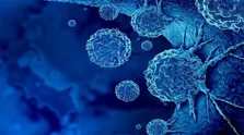 شیمی درمانی قبل و بعد از جراحی در مبتلایان به سرطان مری موثر است