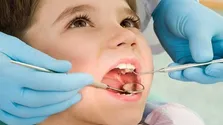 رنگ دندان‌ها درباره سلامت‌تان چه می‌گویند؟