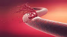 ردپای آمریکا در کمبود یک نوع داروی هموفیلی