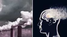 تشخیص زوال عقل با راه رفتن