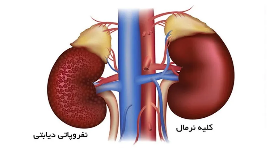 کمردرد شدید نشانه این بیماری جدی است