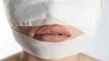 تاثیر بیماری آرتریت پسوریاتیک بر چشم