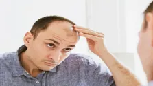 استرس عامل اصلی ریزش مو