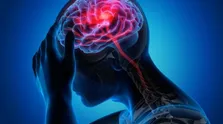چگونه به بیمار سکته مغزی کمک کنیم/ کارهایی که نباید انجام داد