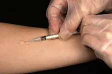 اهمیت دیپلماسی سلامت در منطقه/ توجه به توریسم سلامت در مرزها