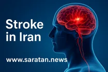 سکته مغزی در ایران دومین علت مرگ و میر است