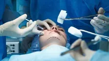 بلفاروپلاستی ظاهر چشم را تغییر نمی‌دهد؛ فقط جوان‌تر می‌کند