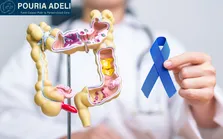 استرس مزمن و تأثیر آن بر پیشرفت سرطان روده بزرگ
