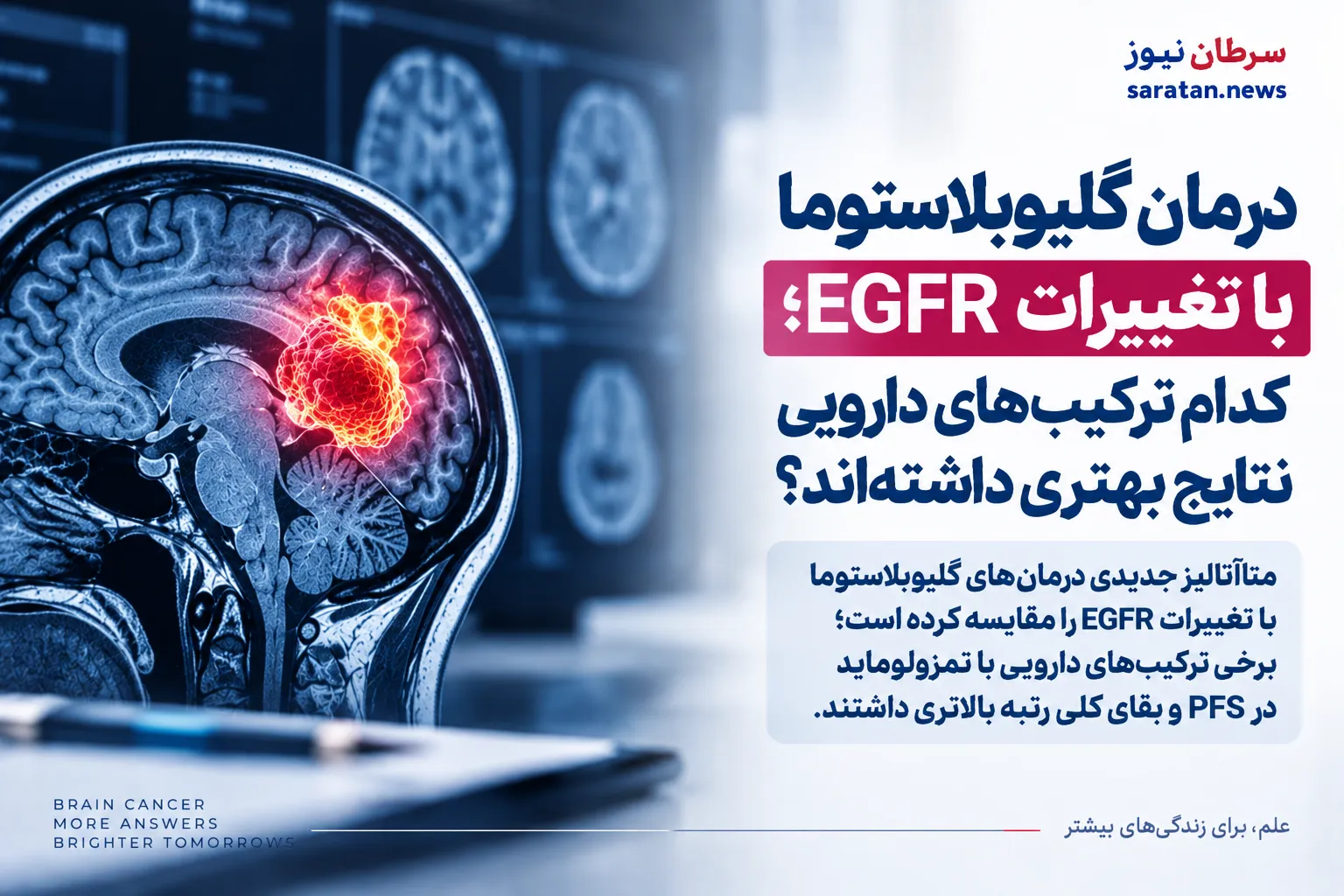 درمان ترکیبی گلیوبلاستوما؛ کدام رژیم‌ها برای تومورهای دارای تغییرات EGFR امیدوارکننده‌ترند؟