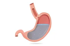 علائم و عوارض رفلاکس معده