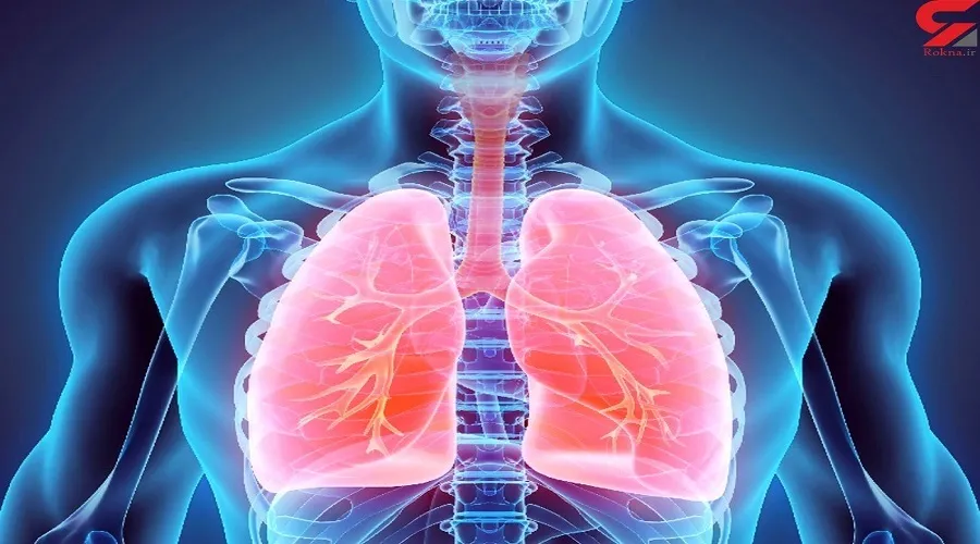 پیشگیری از سرطان ریه با ابداع یک تکنیک جدید