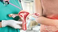 ورزش های هوازی موجب کاهش درد در مبتلایان به سرطان تخمدان می شود
