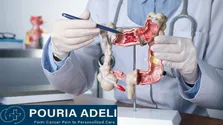 استرس مزمن و تأثیر آن بر پیشرفت سرطان روده بزرگ