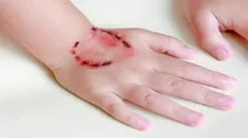 ثبت بیش از ۹۰هزار حیوان‌گزیدگی/ ۷ فوتی به دلیل هاری