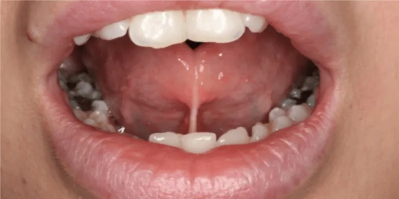 زبان کرواتی به چه شکل است؟