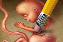 ۹۵ درصد موارد سقط جنین در کشور غیرقانونی است
