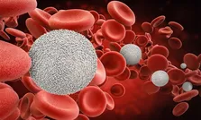کاهش نرخ امید به زندگی در آمریکا