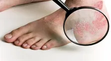 چه زمانی درد قفسه سینه مربوط به قلب است؟