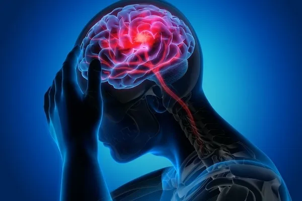 درمان از راه دور بیماران سکته مغزی در خوزستان محقق شد