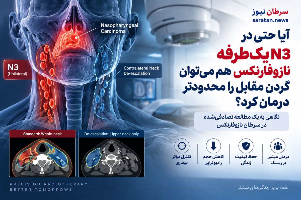 کاهش حجم رادیوتراپی در سرطان نازوفارنکس؛ آیا در N3 یک‌طرفه می‌توان گردن مقابل را محدودتر درمان کرد؟