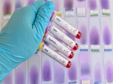 HIV چگونه منتقل می‌شود؟