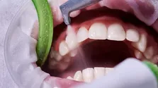 ضربه سر به توپ فوتبال بر سلامت مغز تاثیرگذار است