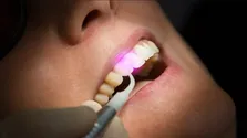 اختصاص بیش از یک همت بودجه برای امور پیشگیری و سلامت دندان در مدارس + فیلم
