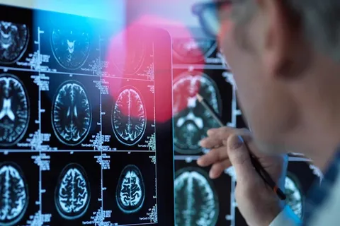 راهکارهای مراقبت از مبتلایان آلزایمر در شرایط جنگی