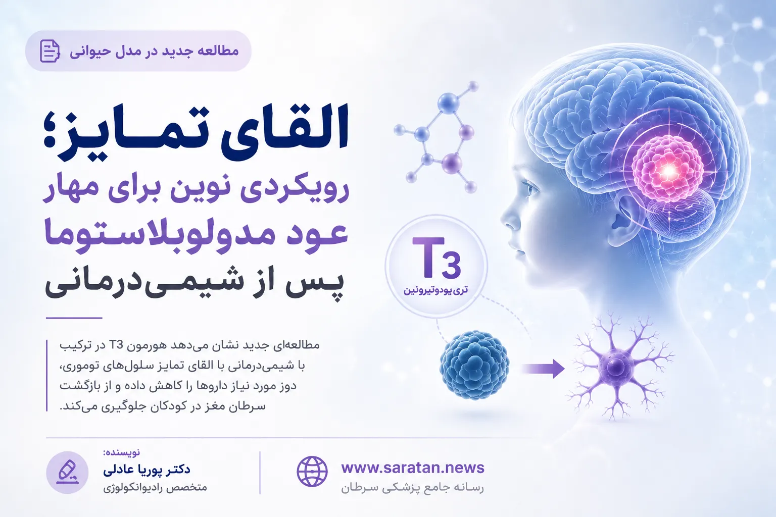 القای تمایز با هورمون T3؛ رویکردی نوین برای پیشگیری از عود مدولوبلاستوما پس از شیمی‌درمانی