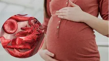 کم‌خوابی، قلب را نشانه می‌گیرد