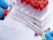 فوت ۲ بیمار کرونایی و شناسایی ۳۵ بیمار جدید