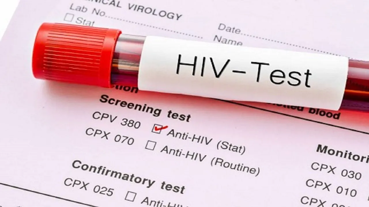 درمان «ایدز» رایگان است/ ویروس HIV قابل کنترل است به شرط درمان