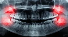 مسواک معمولی بهتر است یا برقی